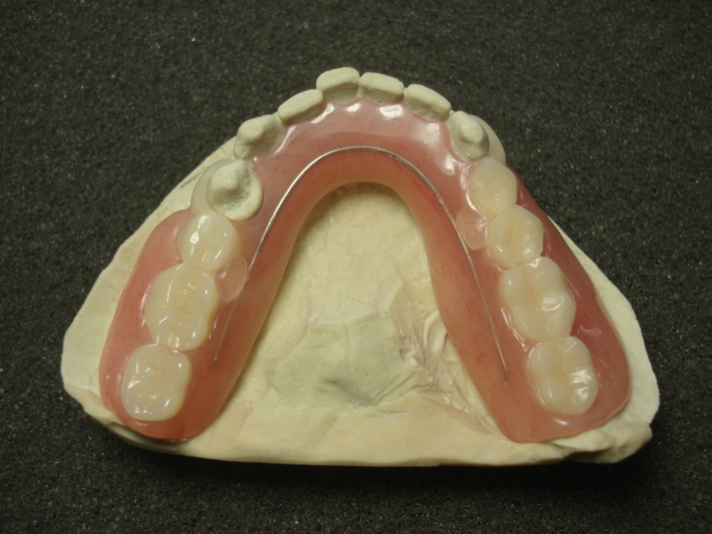 Streamline Dental Lab - Manhattan, New York - Gallery - Dentures ...