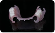 DENTURES TCS FLEXI