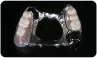 DENTURES CHROME-COBALT